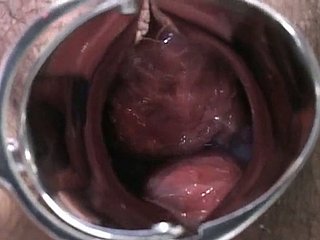 Senhora grávida japonês é examinado e suga lollicock knock off médico